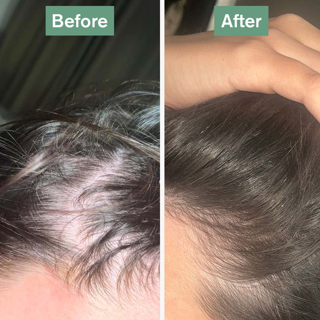DR.VEGAN Hair Saviour®